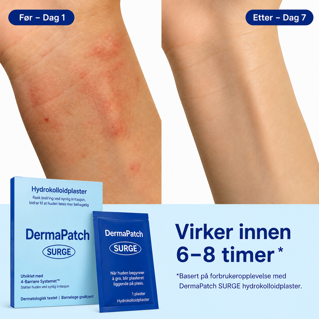 Transparent hudplaster for tørr og eksemutsatt hud
