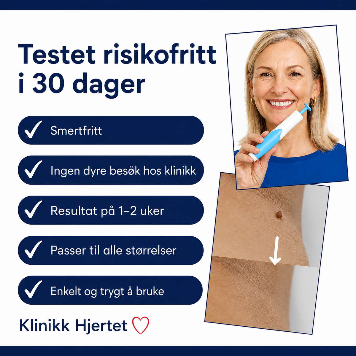 Hudflikfjerner for hjemmebruk – komplett sett for målrettet påføring