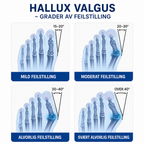 Tåskiller og fotstøtte for hallux valgus