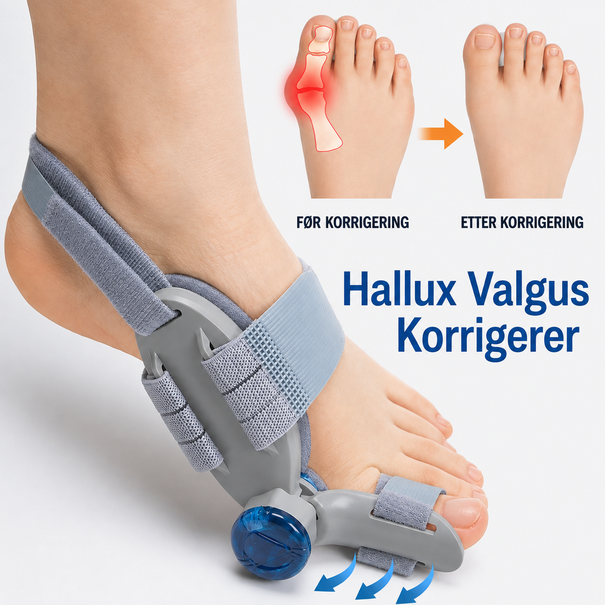 Tåskiller og fotstøtte for hallux valgus