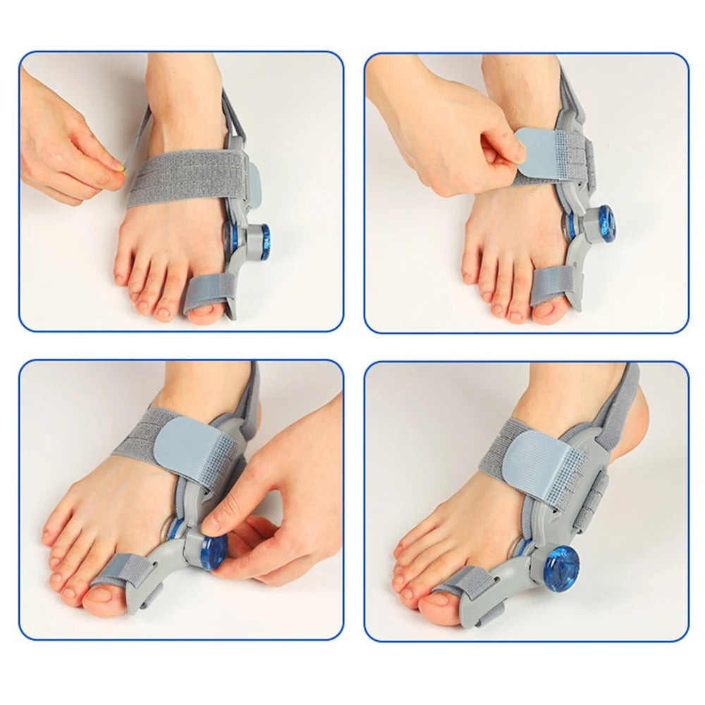Tåskiller og fotstøtte for hallux valgus